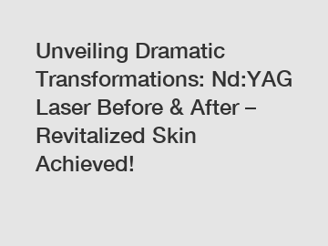 Unveiling Dramatic Transformations: Nd:YAG Laser Before & After – Revitalized Skin Achieved!