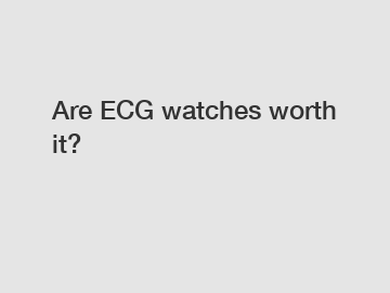 Are ECG watches worth it?