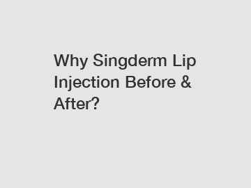 Why Singderm Lip Injection Before & After?