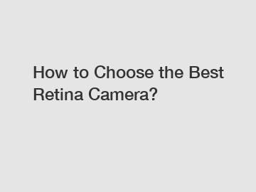 How to Choose the Best Retina Camera?