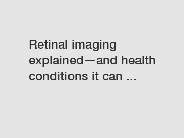 Retinal imaging explained—and health conditions it can ...