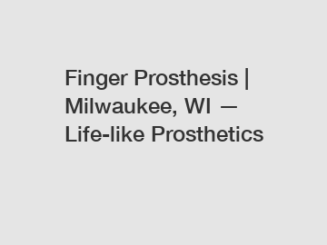 Finger Prosthesis | Milwaukee, WI — Life-like Prosthetics