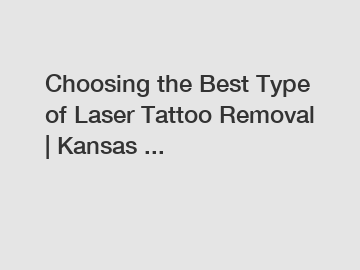 Choosing the Best Type of Laser Tattoo Removal | Kansas ...