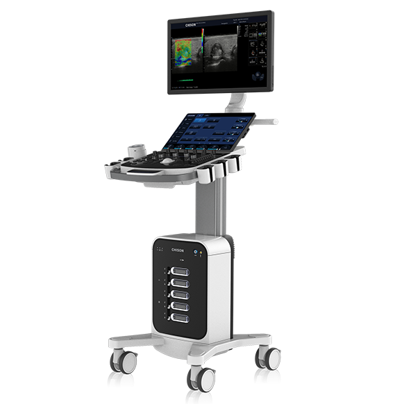 The Evolution of Cart-Based Ultrasound: Advances and Applications