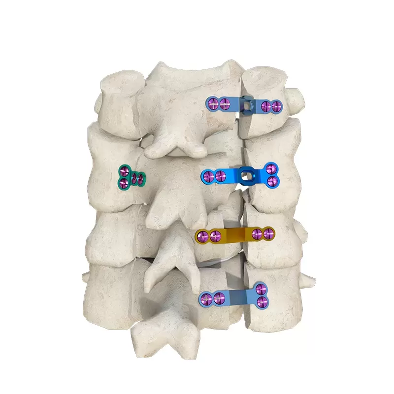 Types of Cervical Spine Implants and Their Applications