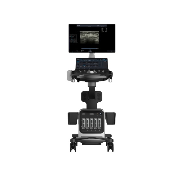 What Should I Look for When Buying an Ultrasound Machine?